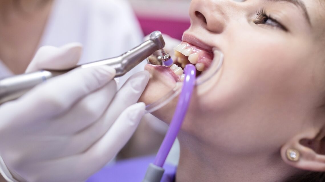 Jakie są podstawowe narzędzia i preparaty do polerowania zębów?