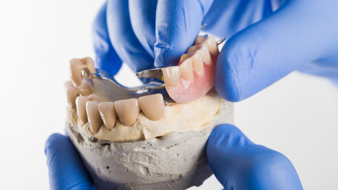 Cechy szkieletowych protez zębowych
